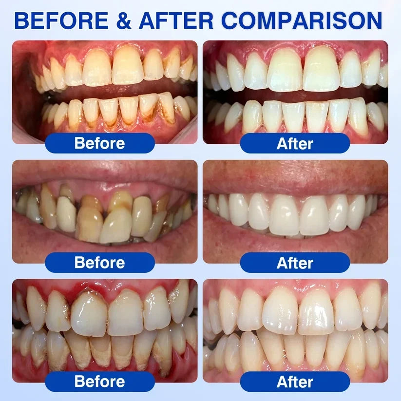 🏆🦷✨Nourizia™ GumRevive Periodontal Repair Gel