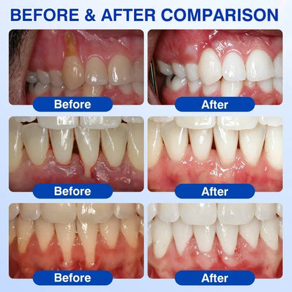 🏆🦷✨Nourizia™ GumRevive Periodontal Repair Gel