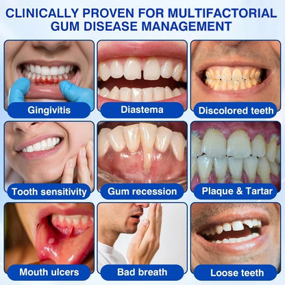 🏆🦷✨Nourizia™ GumRevive Periodontal Repair Gel