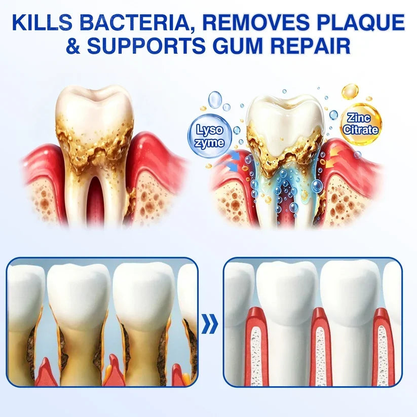 🏆🦷✨Nourizia™ GumRevive Periodontal Repair Gel