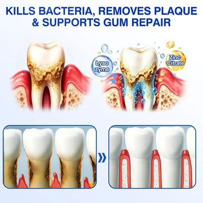 🏆🦷✨Nourizia™ GumRevive Periodontal Repair Gel