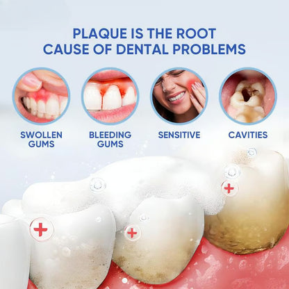 (✨BUY 3 GET 2 FREE🎁) LOVILDS™ Niacinamide Whitening Toothpaste